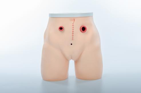 瘺管造口術(shù)護(hù)理仿真模型 瘺管造口術(shù)護(hù)理仿真模型